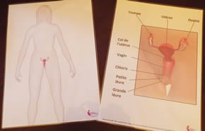 une femme enceinte à terme.