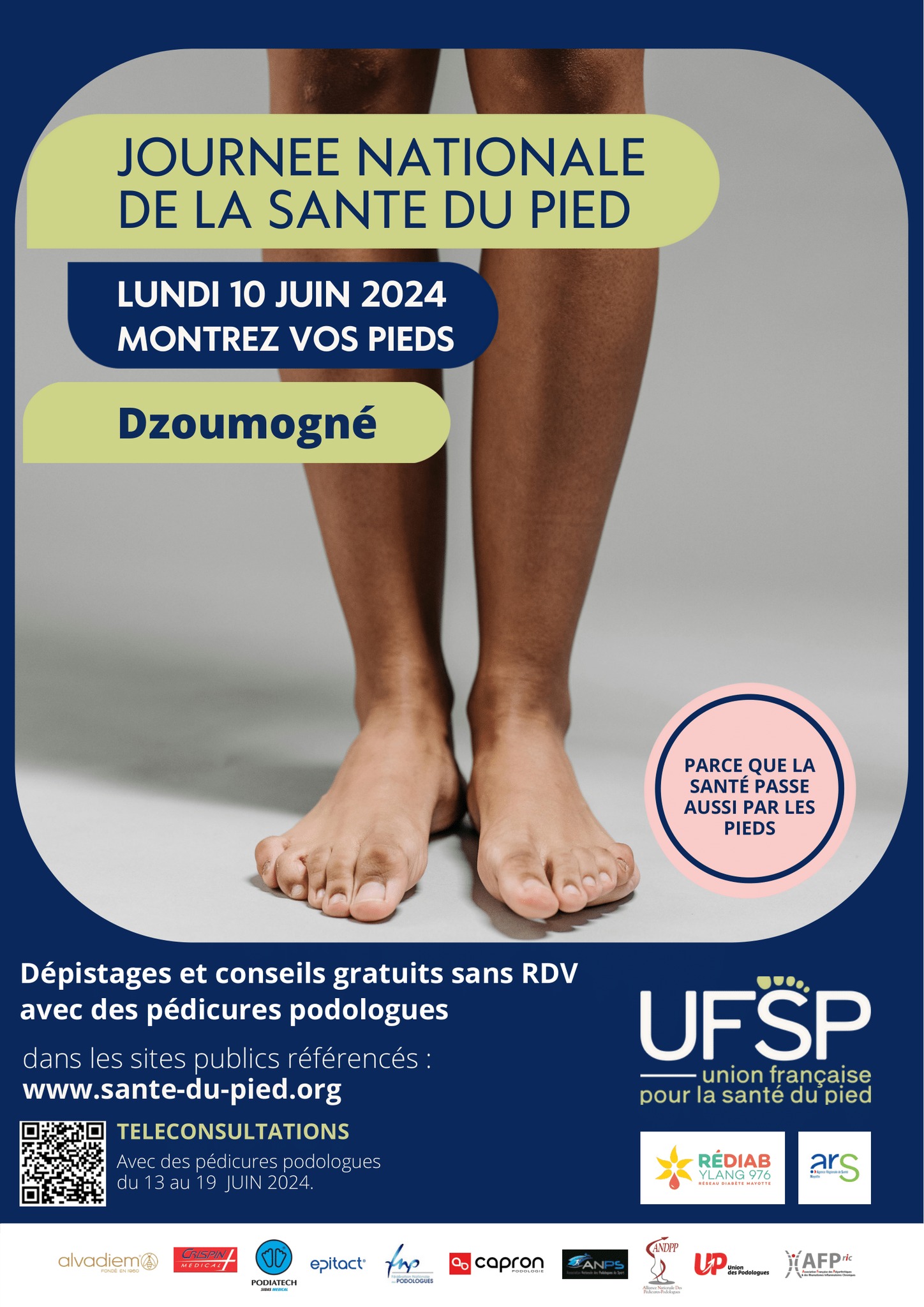Le 10 juin, montrez vos pieds à Dzoumogné !