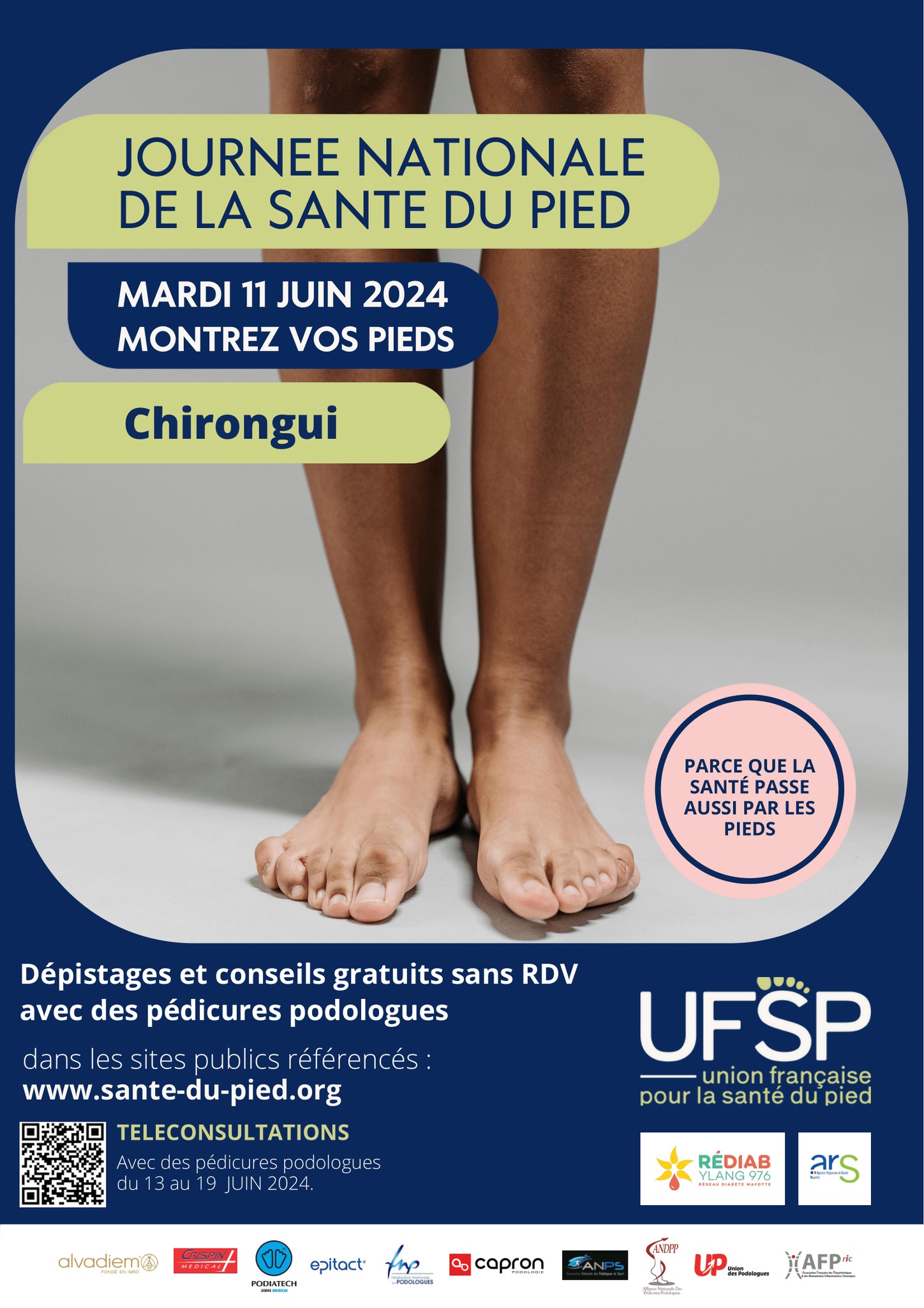 Le 11 juin, montrez vos pieds à Chirongui !