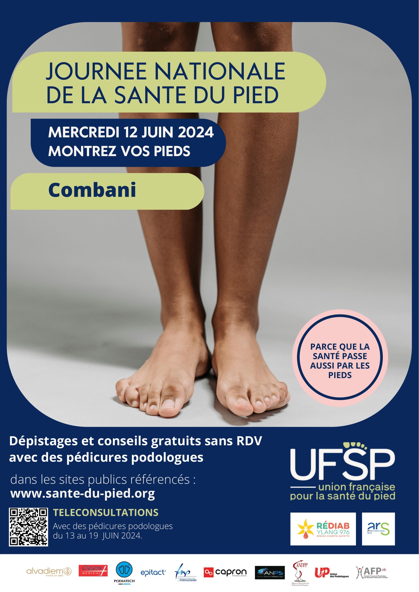 Le 12 juin, montrez vos pieds à Combani !